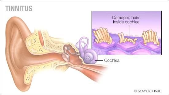 Effective Tinnitus Cure in Pakistan & ASSR Hearing Test Price